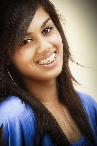 braces in salt lake city utah