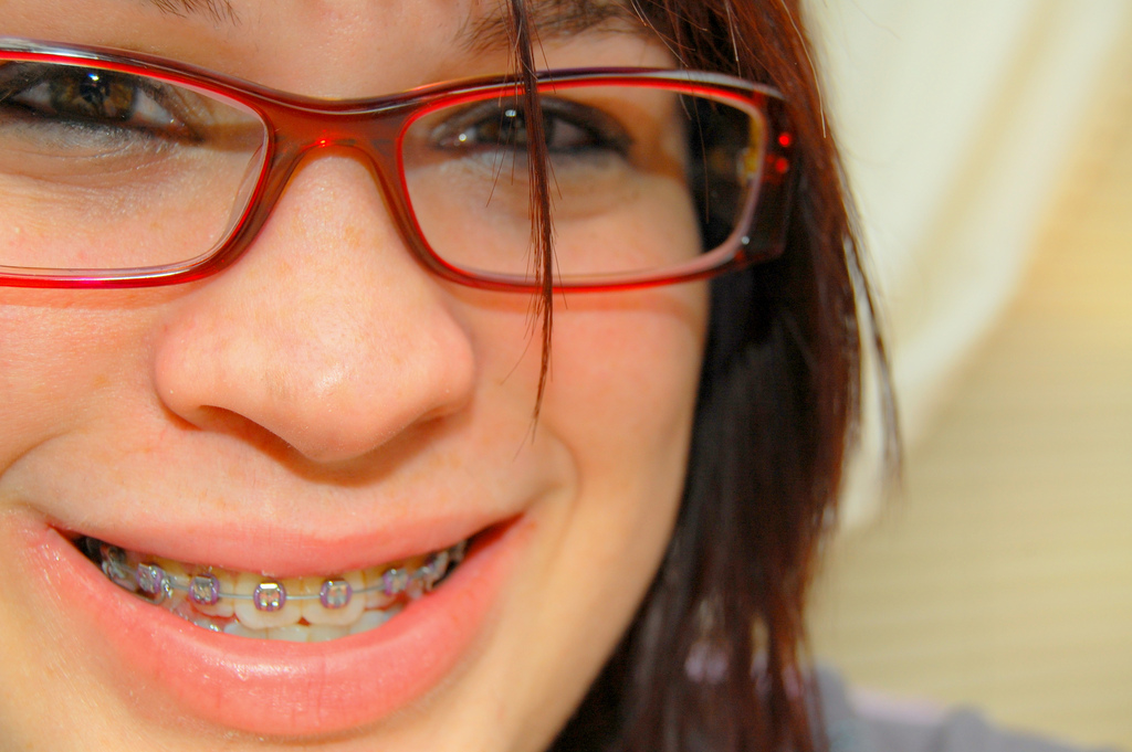 Life Hacks for Braces McDonough Orthodontics of Utah