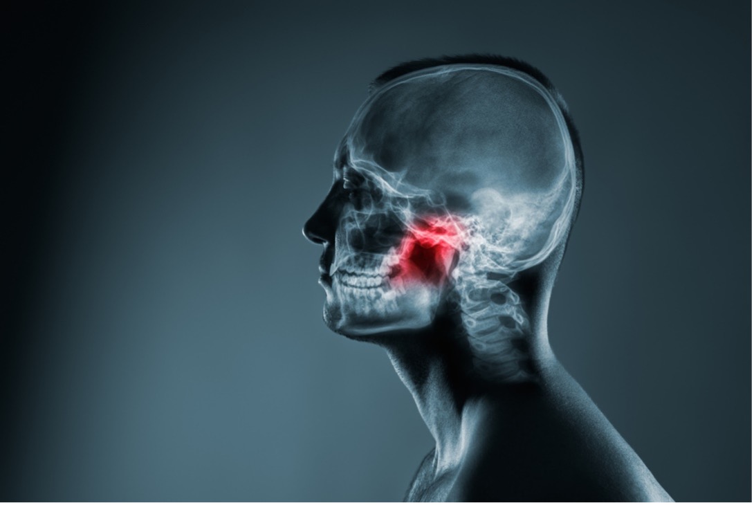 x-ray type illustration with red highlighting around jaw