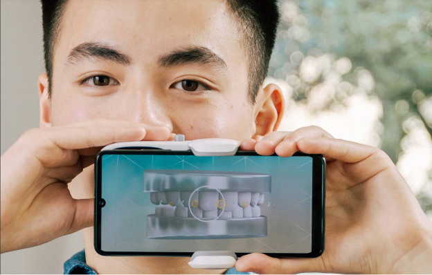 A person holding a cellphone with a 3d model of teeth, Digital Orthodontic Monitoring