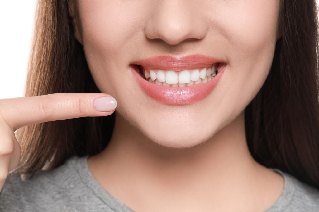 A close-up of a person's smile, Overbite Teeth: Navigating Treatment Options for a Brighter Smile