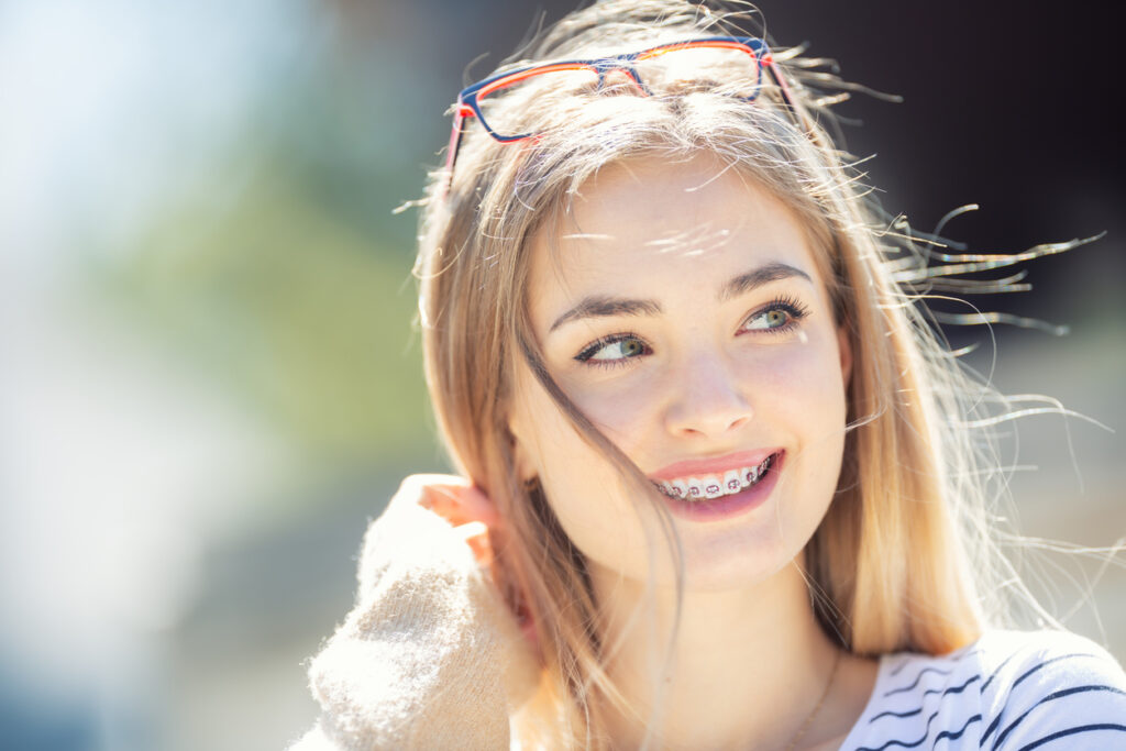 A person smiling with braces on her teeth, Getting Started with Braces or Clear Aligners: A Summer Smile Makeover