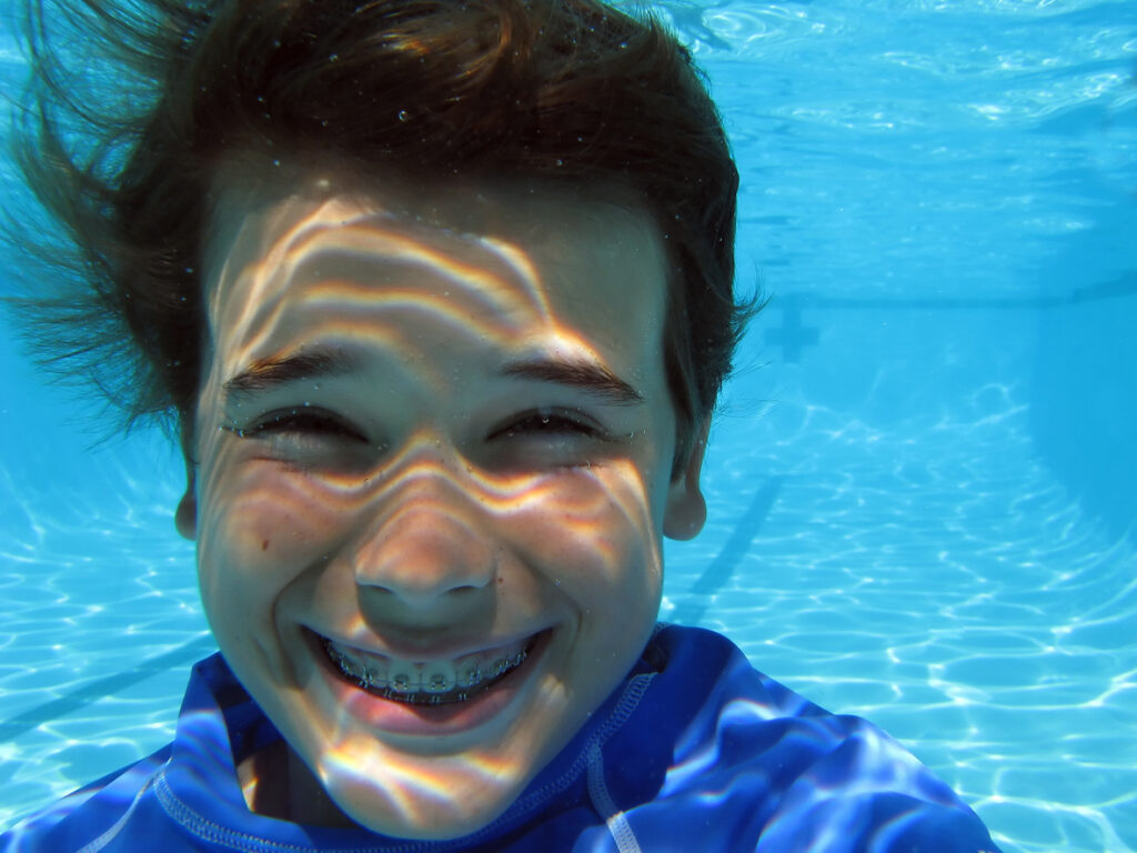 A child smiling under water, Enjoying the Summer with Braces: Tips from McDonough Orthodontics