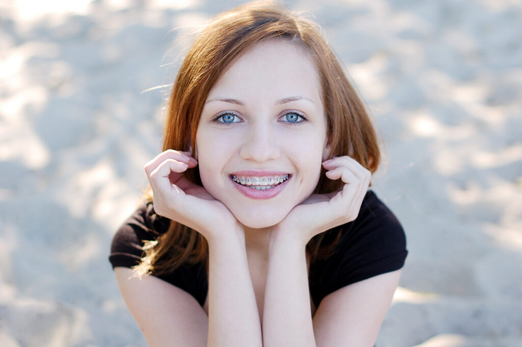 A person with braces smiling, Unveiling the Truth About Braces: Debunking Common Myths