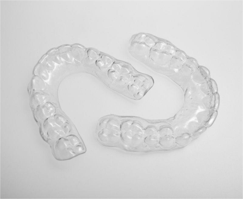 Plastic Retainers